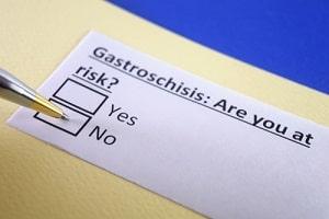 Illinois birth injury attorney Gastroschisis