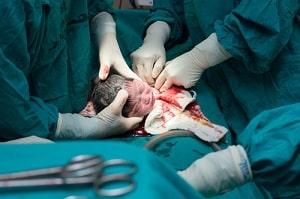 Cook County medical malpractice attorney birth injury